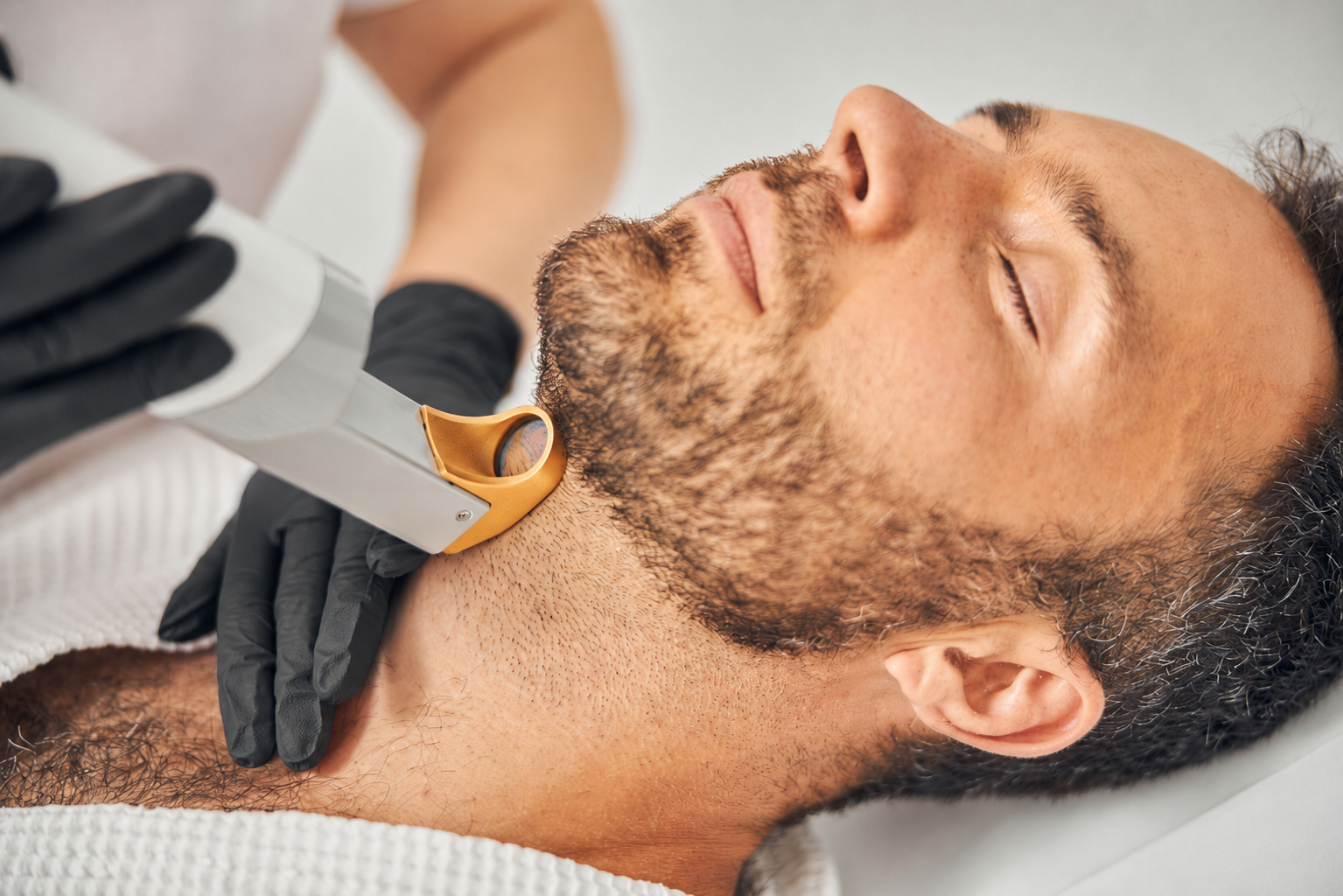 Épilation laser pour hommes | Rive-Sud de Montréal | Centre d'Esthétique Novani